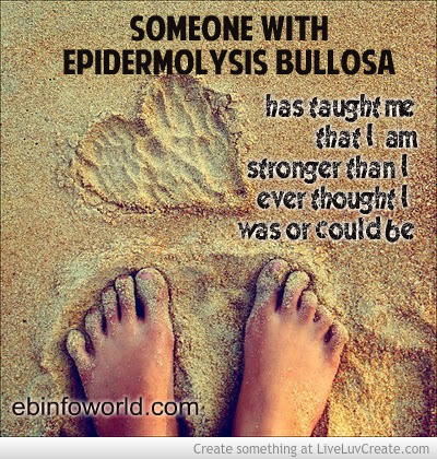 epidermolysis_bullosa_awareness-685400